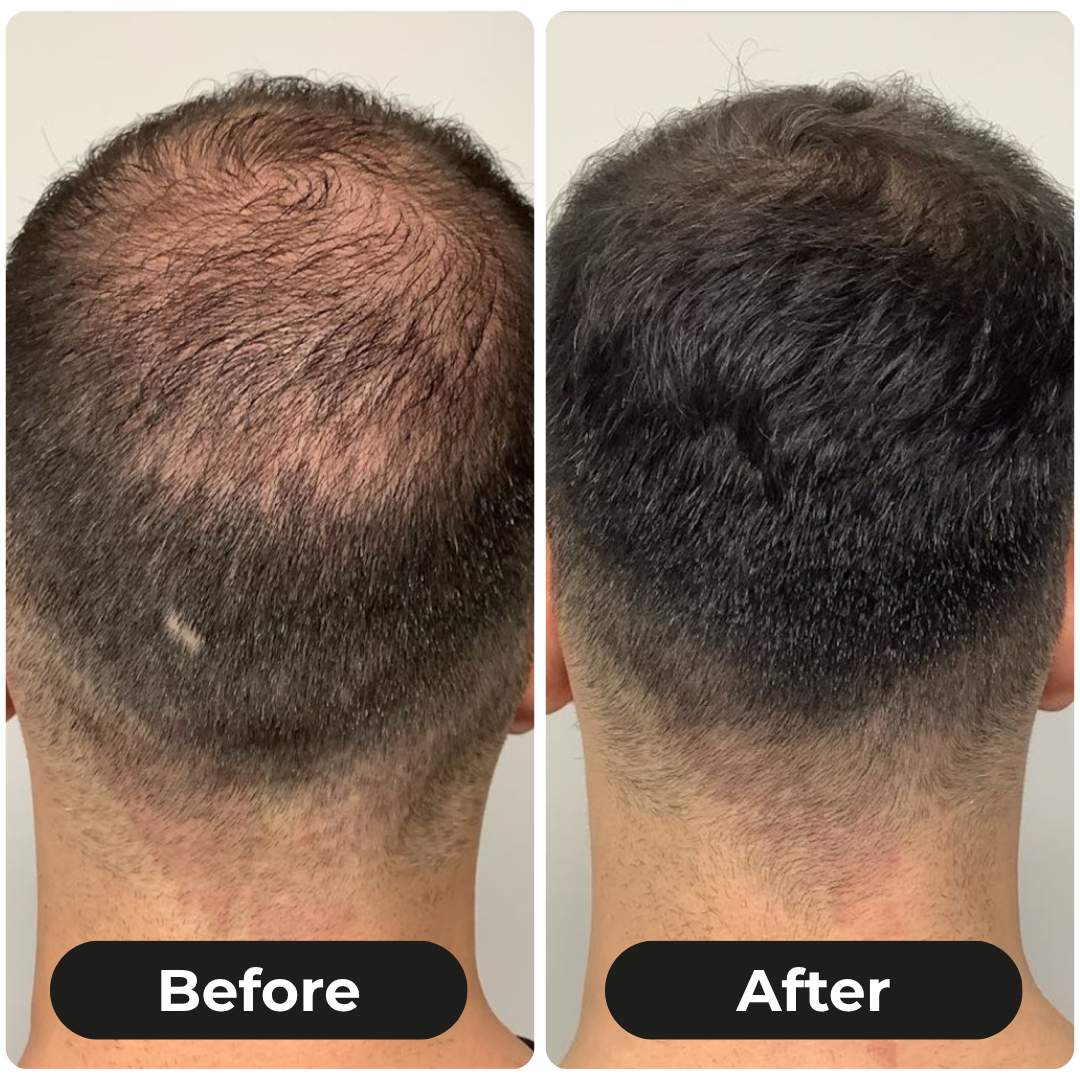 ThickLuxe Root Activating  Shampoo