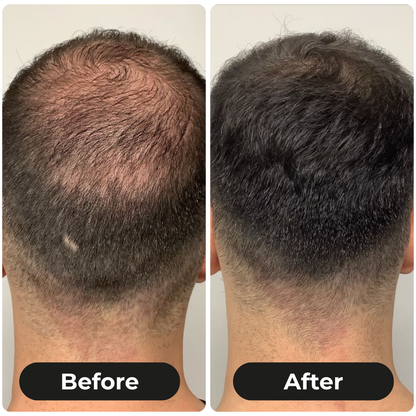 ThickLuxe Root Activating  Shampoo